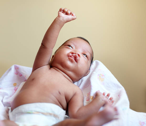 Reaching out to tomorrow Shot of a baby girl who has a cleft palate lying on a bed cleft lip stock pictures, royalty-free photos & images