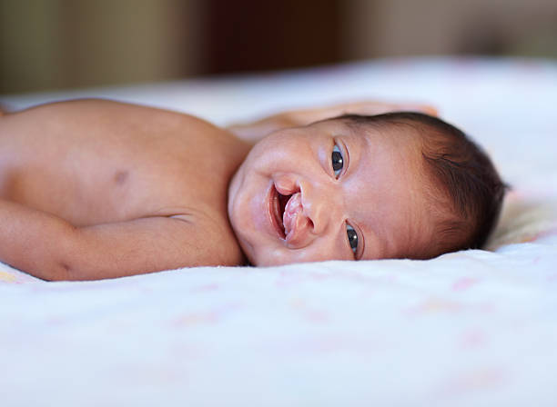 She's such an angel Portrait of a baby girl with a cleft palate lying on a bed cleft lip stock pictures, royalty-free photos & images
