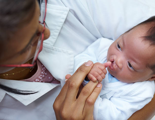 Little trooper A female nurse holding a baby girl who has a cleft palate cleft lip stock pictures, royalty-free photos & images