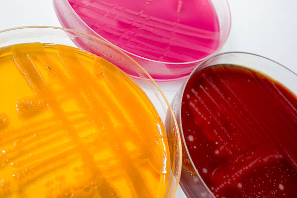 istock Petri dishes with bacteria colonies 526149752