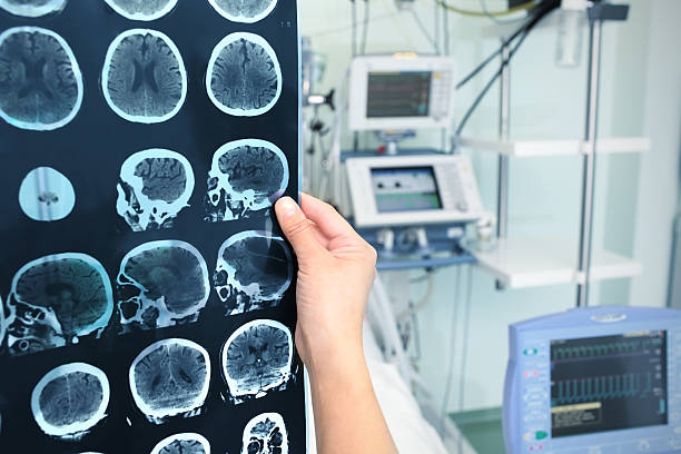 interpretacja tomografii mózgu w oit - brain surgery mri scanner cat scan oncology zdjęcia i obrazy z banku zdjęć