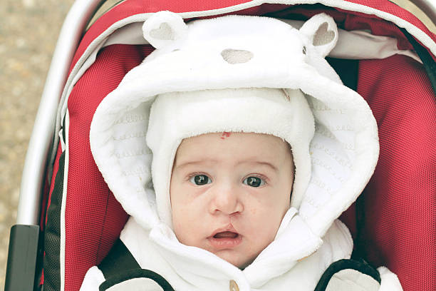 Baby in winter Baby looks at the camera cleft lip stock pictures, royalty-free photos & images