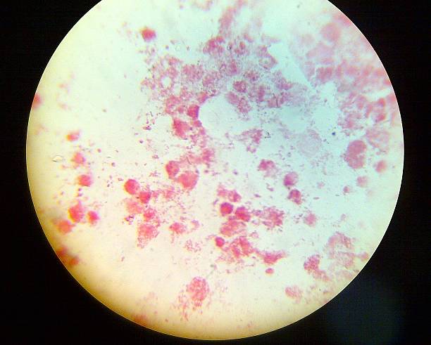 Neisseria Gonorrhea