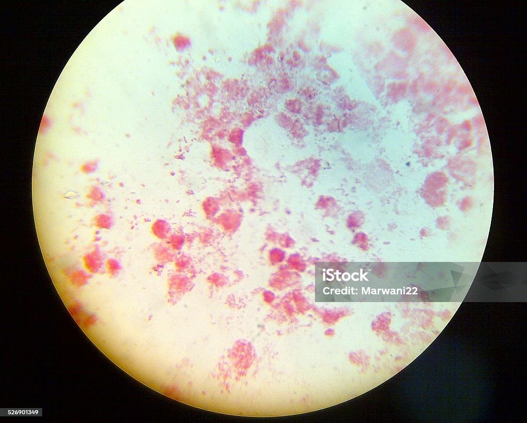 Neisseria Gonorrhea A slide containing a sexually transmitted organism. Gonorrhea Bacterium Stock Photo