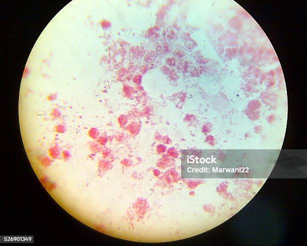 Neisseria Gonorrhea Stock Photo - Download Image Now - Gonorrhea Bacterium, Gram Stain, Microscope Slide