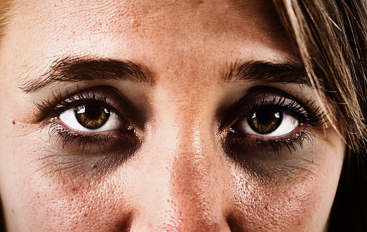 Cropped close up of a woman's sad, exhausted brown eyes, ringed with dark circles and looking straight at the camera.