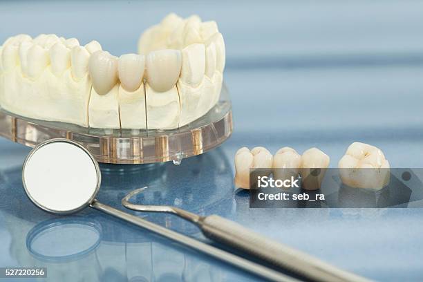 Gesundheit Zahnpflege Stockfoto und mehr Bilder von Zahnkrone - Zahnkrone, Brücke, Zahnpflege