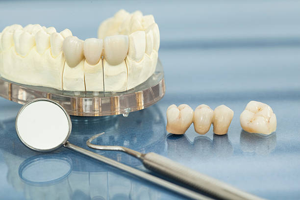 Dental health care Dental health care dental crown stock pictures, royalty-free photos & images