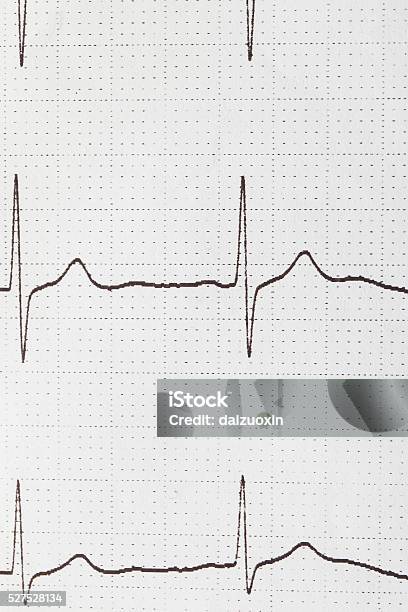 Electrocardiogram Chart Stock Photo - Download Image Now - Electrocardiography, In A Row, Analyzing