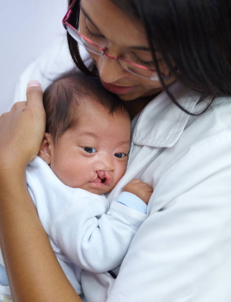 Giving comfort is key in her profession Shot of a young female nurse holding a baby who has a cleft palate cleft lip stock pictures, royalty-free photos & images
