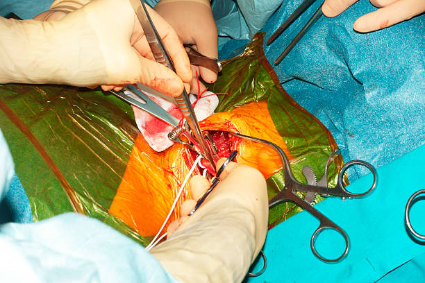 сонная хирургического вмешательства - surgery human artery human hand carotid artery стоковые фото и изображения