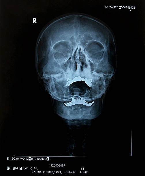 人の頭蓋骨 xray - radiogram photographic image ストックフォトと画像