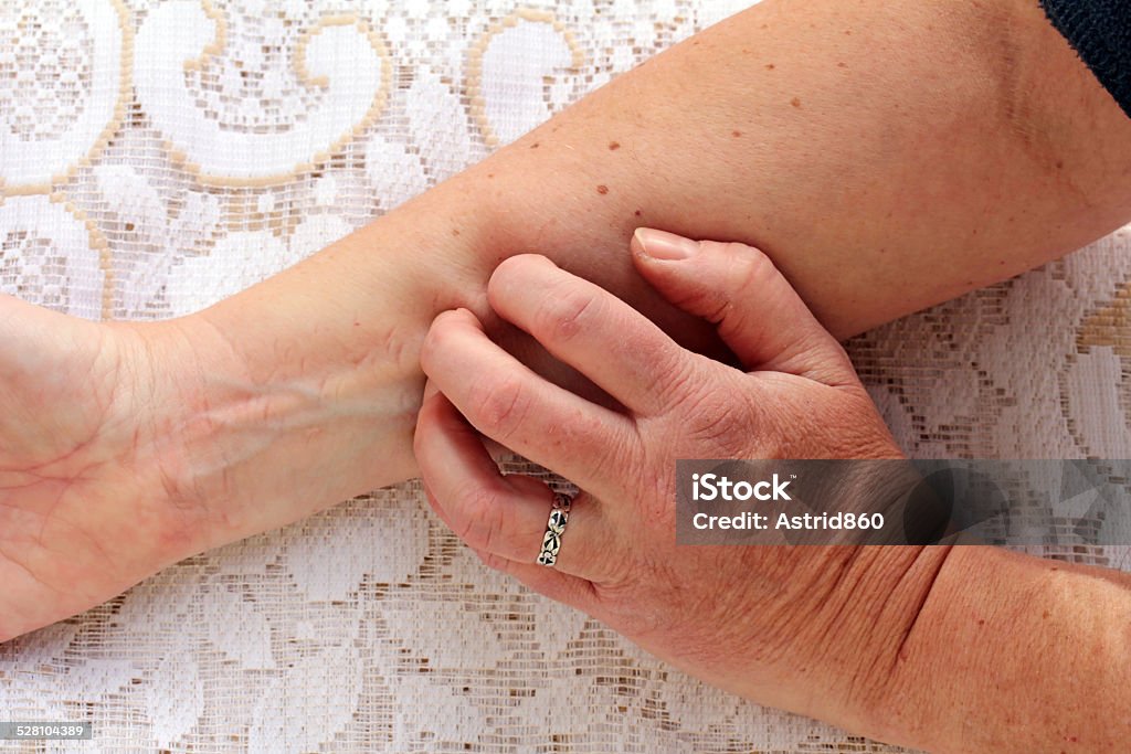 itchy skin dry itchy skin Scratching Stock Photo