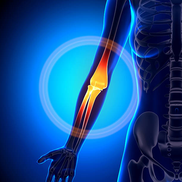 istock Female Elbow - Anatomy Bones 528137511