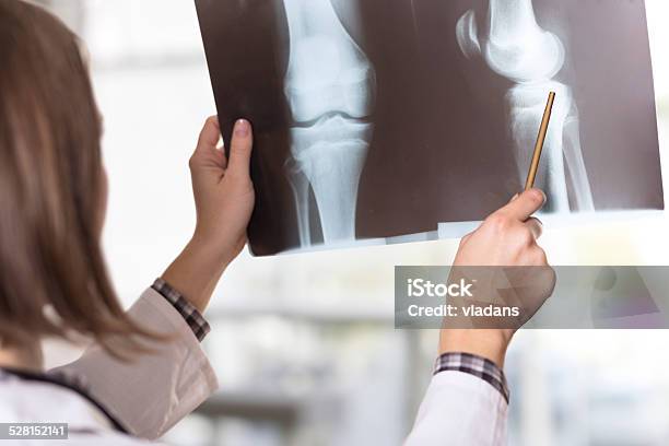 Xrayscan Stockfoto und mehr Bilder von Röntgenbild - Röntgenbild, Medizinisches Röntgenbild, Knochenbruch