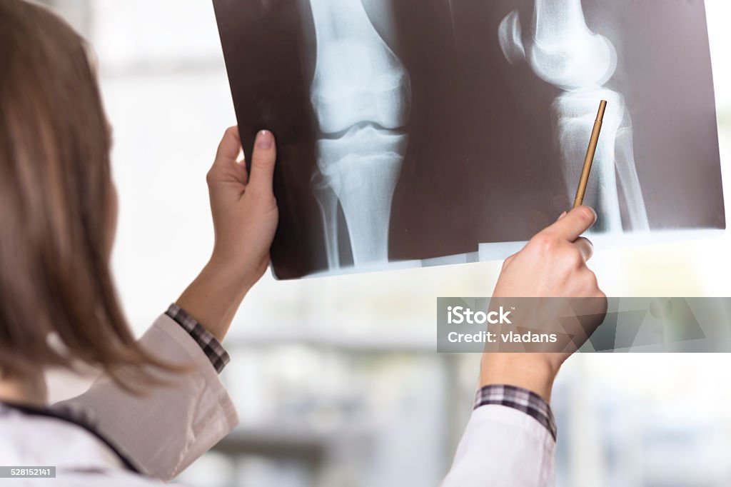 X-ray scan Young female doctor looking at the x-ray picture of knee injury in a hospital X-ray Image Stock Photo