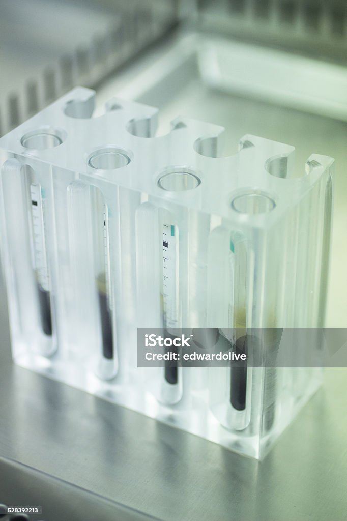 Medical laboratory test tubes human growth factors Medical laboratory preparation of human growth factors in hospital clinic for orthopedic surgery and Traumatology rehabilitation treatment with test tubes in sterile environment. Activity Stock Photo