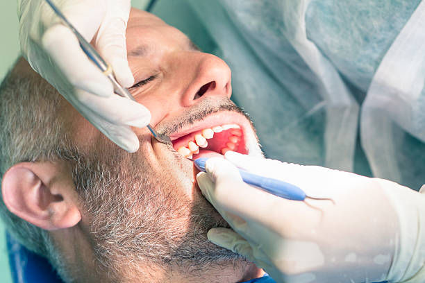 homem doente de sofrimento durante a higiene dentária em consultório dentário - dentist pain human teeth toothache imagens e fotografias de stock