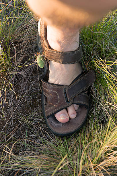 istock Cactus Stuck in Man's Sandal and Ankle 528554390