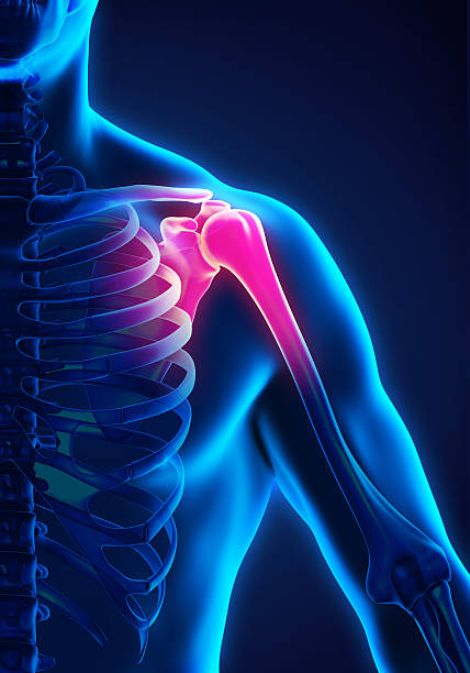 istock Painful Shoulder Illustration 528581060