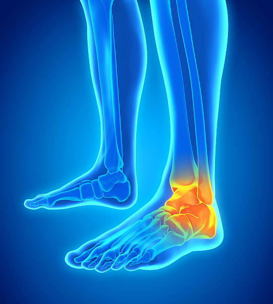 istock Painful Ankle Illustration 528605650