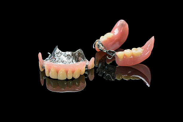 Removable partial denture stock photo