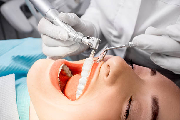Professional teeth cleaning Dentist making professional teeth cleaning female young patient at the dental office. Close-up plan human teeth stock pictures, royalty-free photos & images