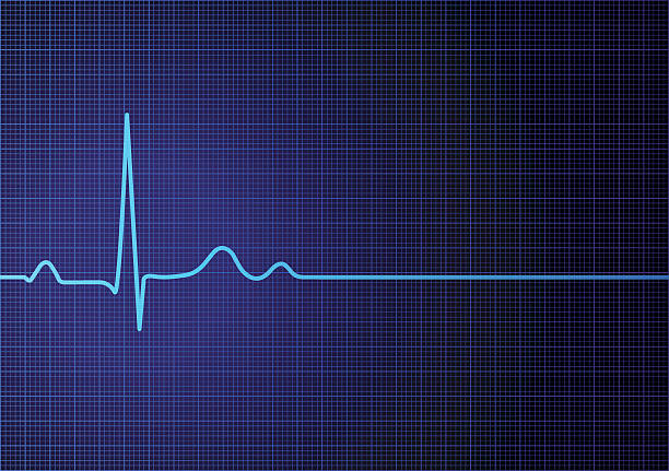 plochá linka ekg - sledování pulzu stock ilustrace
