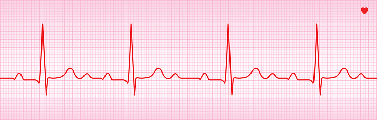 Vector ECG Trace. PDF file is included.