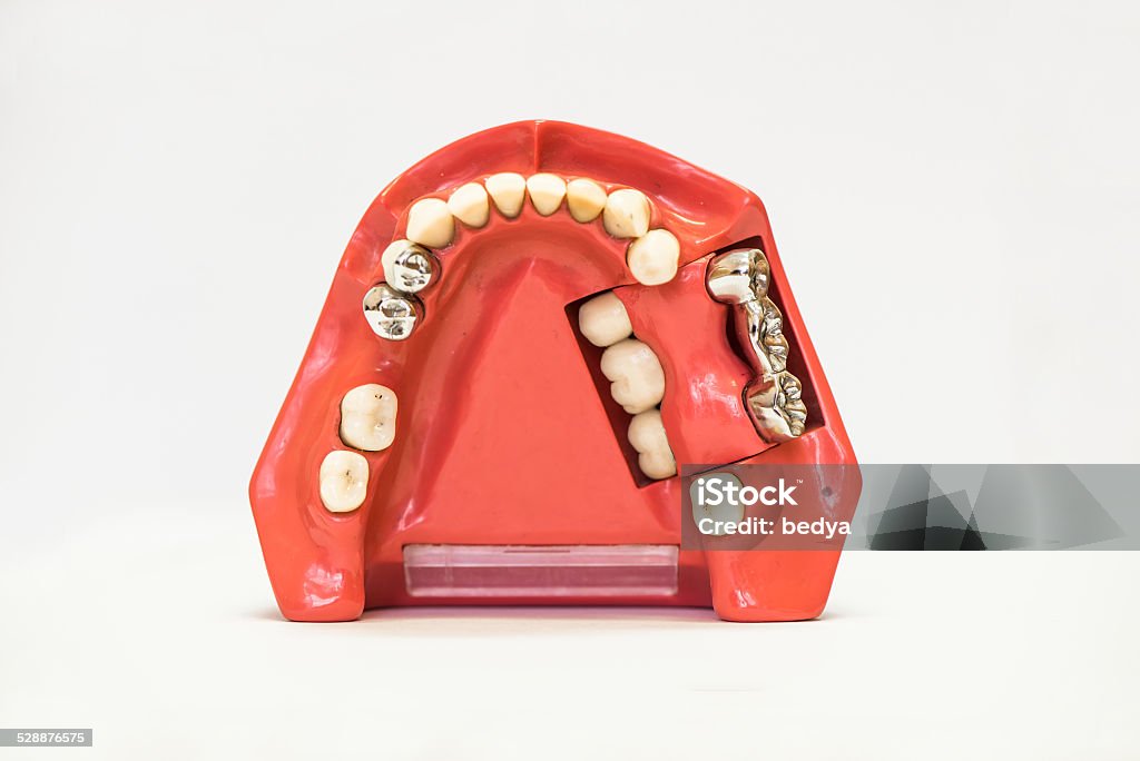 Dental dentures isolated on white Dental phantom, dentures isolated on white background Artificial Stock Photo