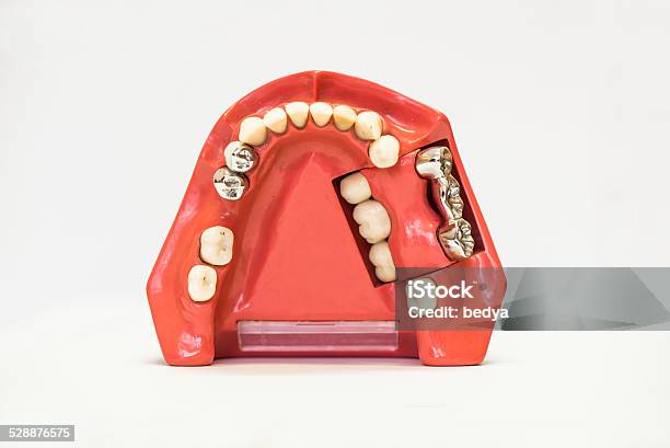 Dental Dentures Isolated On White Stock Photo - Download Image Now - Artificial, Biting, Bridge - Built Structure