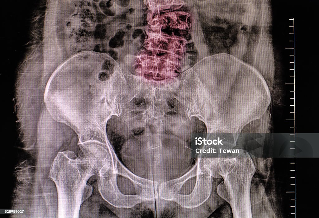 X-ray of the pelvis and spinal column Adult Stock Photo