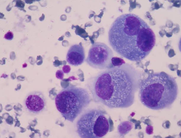 istock Cancer Cell in human showing abnormal cells. 529407718