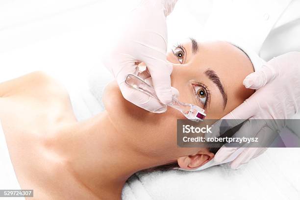 Micro Needle Mesotherapy Treatment Stock Photo - Download Image Now - Acid, Adolescence, Adult