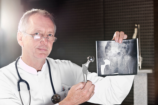 A male doctor, demonstrating a total hip endoprothesis in front of an x-ray image. XXL size image.