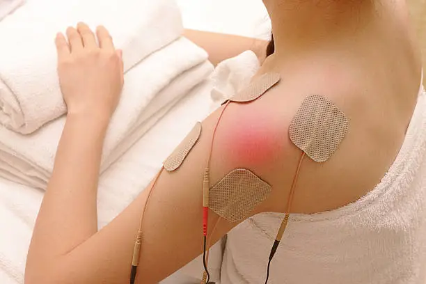 Asian woman is doing massage of electrical -stimulation ( TENs ) for the shoulder