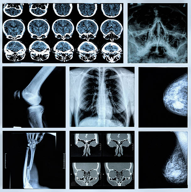 radiography menschlicher knochen - mammogram mri scan breast breast examination stock-fotos und bilder