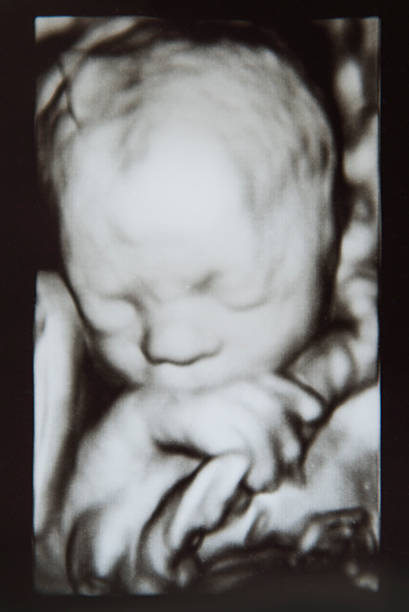 Ultrasound 3D Baby fetus in 3D holding the umbilical cord.  uterus photos stock pictures, royalty-free photos & images
