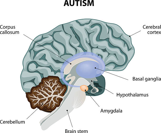 autism Parts of the brain affected by autism. Vector diagram thalamus illustrations stock illustrations
