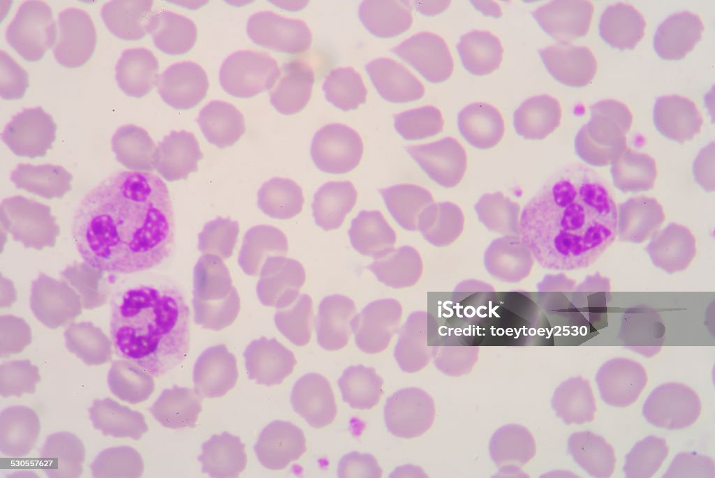 Blood smear Antigen Stock Photo