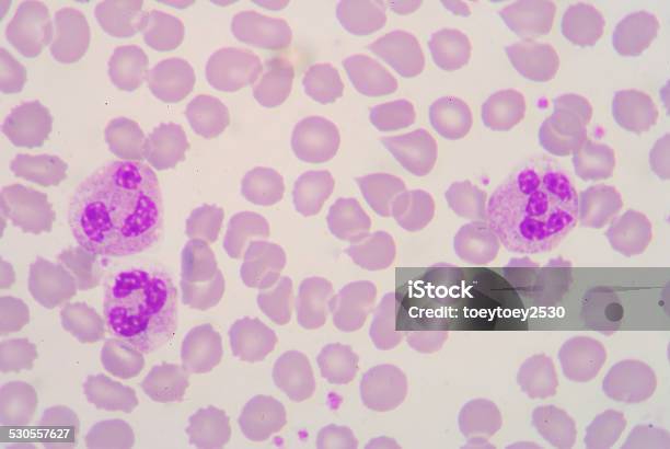 Blood Smear Stock Photo - Download Image Now - Antigen, Basophil, Biology