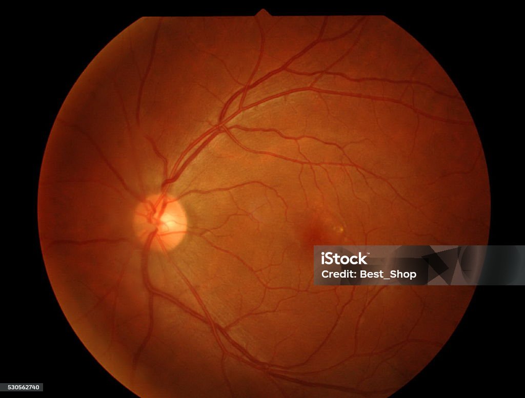 Optical Coherence Tomography (OCT) Medical Exam Stock Photo