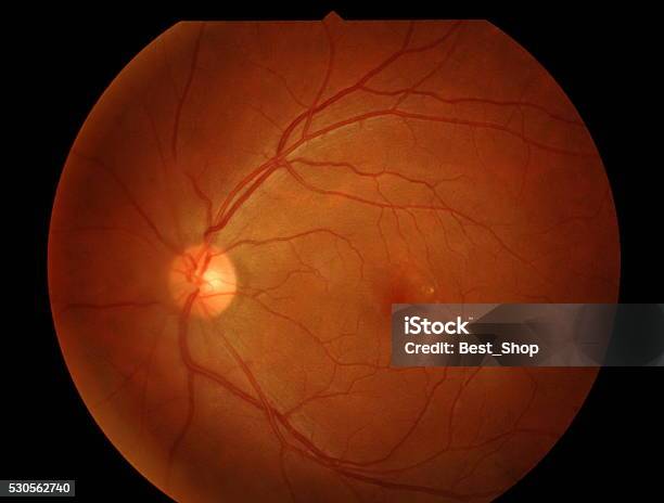Optical Coherence Tomography Stock Photo - Download Image Now - Medical Exam, Retina, Retinopathy