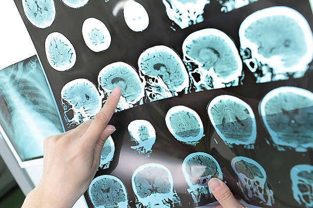 istock doctor view output CT scan. 530567091