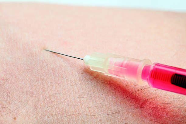 inyección. primer plano de fotos - surgical needle syringe prick injecting fotografías e imágenes de stock
