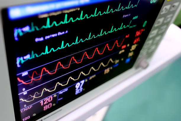 Medical background. Monitor with varicolored schedules (curves) Medical background. Monitor with varicolored schedules (curves) electrocardiography photos stock pictures, royalty-free photos & images