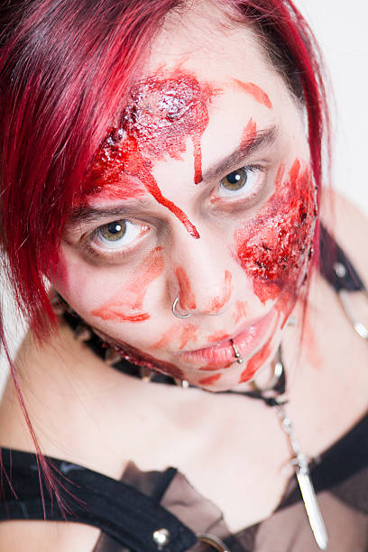 istock Accident Girl 530732391