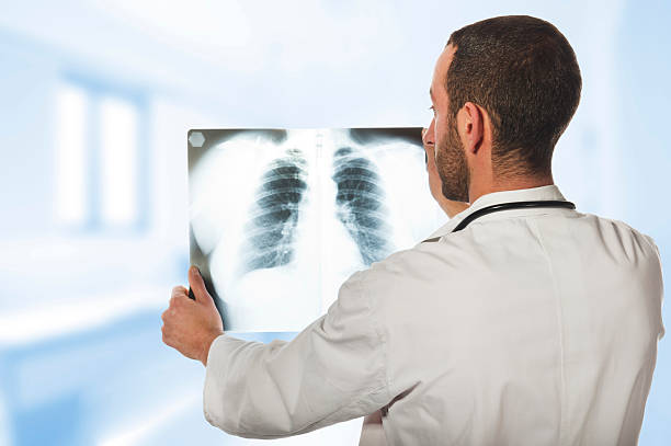 istock doctor looking at the x-ray 530815429