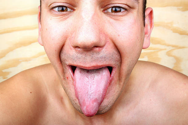 Infection tongue Infection tongue disease candida albicans male yeast infection symptoms stock pictures, royalty-free photos & images