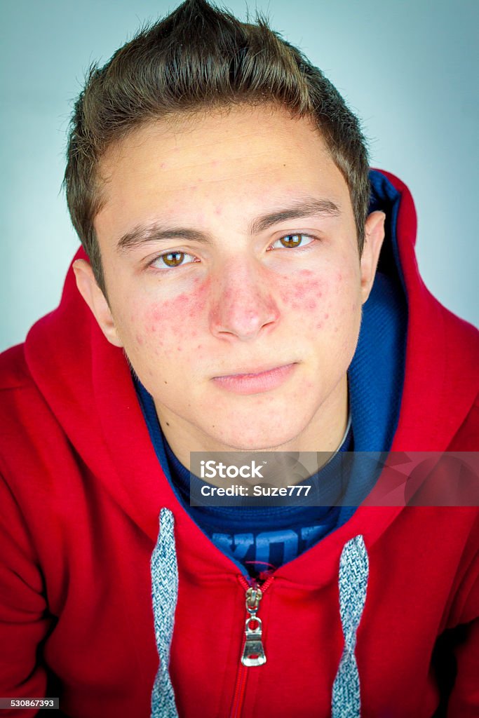 Portrait of teenage boy with acne Portrait of teenage boy with acne. Serious facePortrait of teenage boy with acne. Serious facePortrait of teenage boy with acne. Serious face Beautiful People Stock Photo